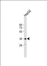 HSD17B13 Antibody in Western Blot (WB)