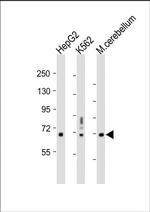 TCF4 Antibody in Western Blot (WB)