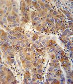 VAMP4 Antibody in Immunohistochemistry (Paraffin) (IHC (P))