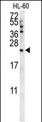 COQ7 Antibody in Western Blot (WB)