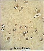 DIRAS3 Antibody in Immunohistochemistry (Paraffin) (IHC (P))