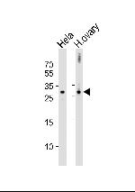 DIRAS3 Antibody in Western Blot (WB)