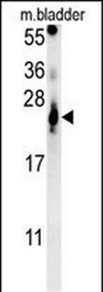 ATP5G2 Antibody in Western Blot (WB)