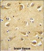 Clathrin Heavy Chain Antibody in Immunohistochemistry (Paraffin) (IHC (P))