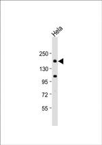 Clathrin Heavy Chain Antibody in Western Blot (WB)