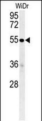 C4BPA Antibody in Western Blot (WB)