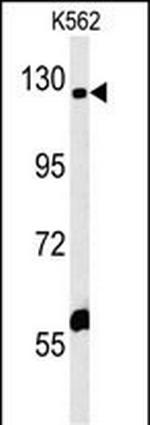 IQSEC3 Antibody in Western Blot (WB)