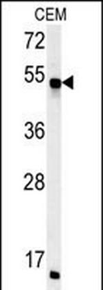 FKBP8 Antibody in Western Blot (WB)