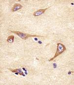 NPTX1 Antibody in Immunohistochemistry (Paraffin) (IHC (P))