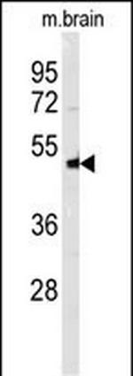 NPTX1 Antibody in Western Blot (WB)