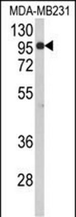 BAHD1 Antibody in Western Blot (WB)