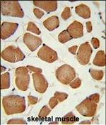 ANGPTL4 Antibody in Immunohistochemistry (Paraffin) (IHC (P))