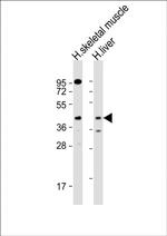 ANGPTL4 Antibody in Western Blot (WB)