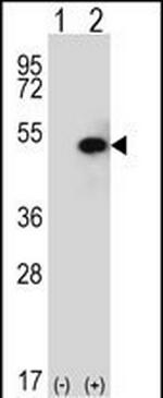 SPHK1 Antibody in Western Blot (WB)