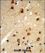 CENPK Antibody in Immunohistochemistry (Paraffin) (IHC (P))