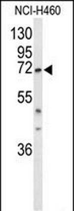 DDX17 Antibody in Western Blot (WB)