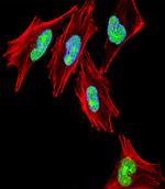 TBX1 Antibody in Immunocytochemistry (ICC/IF)