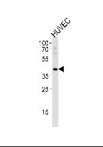 TBX1 Antibody in Western Blot (WB)