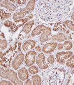 FBXL5 Antibody in Immunohistochemistry (Paraffin) (IHC (P))