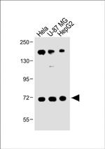 FBXL5 Antibody in Western Blot (WB)