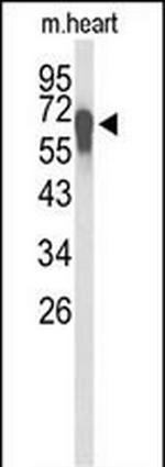 FBXL5 Antibody in Western Blot (WB)