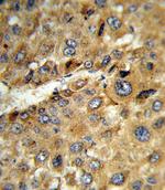 TAT Antibody in Immunohistochemistry (Paraffin) (IHC (P))