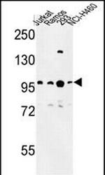 BCL11A Antibody in Western Blot (WB)