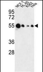 AIM2 Antibody in Western Blot (WB)