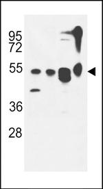 ATG13 Antibody in Western Blot (WB)