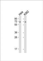 YTHDF3 Antibody in Western Blot (WB)