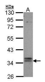 TGR5 Antibody in Western Blot (WB)