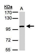 ABR Antibody in Western Blot (WB)