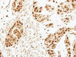 CENPF Antibody in Immunohistochemistry (Paraffin) (IHC (P))