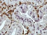 DAB2 Antibody in Immunohistochemistry (IHC)