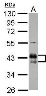 FCGR2B Antibody in Western Blot (WB)