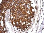 Aladin Antibody in Immunohistochemistry (Paraffin) (IHC (P))