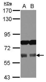 Aladin Antibody in Western Blot (WB)