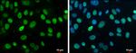 Rb Antibody in Immunocytochemistry (ICC/IF)