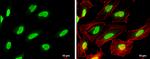 PARP1 Antibody in Immunocytochemistry (ICC/IF)