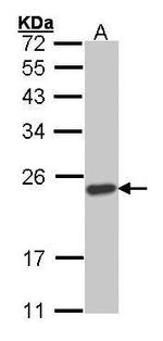 SOCS1 Antibody in Western Blot (WB)