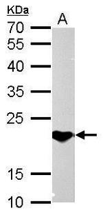 SOCS1 Antibody in Western Blot (WB)