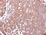 MUC4 Antibody in Immunohistochemistry (Paraffin) (IHC (P))