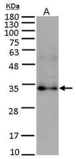 FGF10 Antibody in Western Blot (WB)