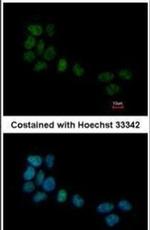 SRF Antibody in Immunocytochemistry (ICC/IF)