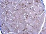 SRF Antibody in Immunohistochemistry (Paraffin) (IHC (P))