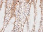 HADHA Antibody in Immunohistochemistry (Paraffin) (IHC (P))