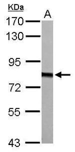 HADHA Antibody in Western Blot (WB)