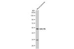 Lyn Antibody in Western Blot (WB)