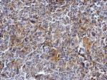 Btk Antibody in Immunohistochemistry (Paraffin) (IHC (P))