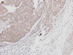 Btk Antibody in Immunohistochemistry (Paraffin) (IHC (P))